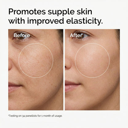 Micro Infusion System