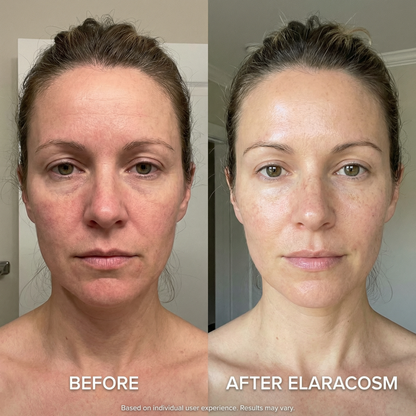 Micro Infusion System