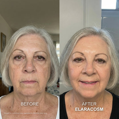 Micro Infusion System