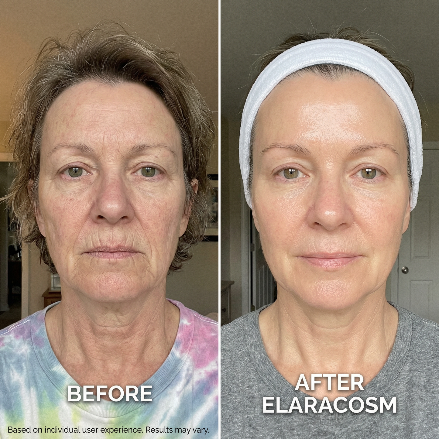 Micro Infusion System